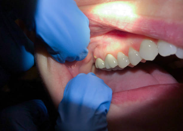 Best Pediatric Emergency Dentist in Belle Plaine, MN